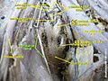 Obturator nerve