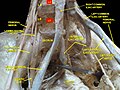 Lumbar and sacral plexus. Deep dissection.Anterior view.