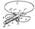 Elektrický přístroj proti chlapecké masturbaci Alberta V. Todda z roku 1903. Obsahuje ostny, elektrické šoky a výstražný zvonek, kterým chlapce odnaučuje erekci.