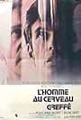 L'homme au cerveau greffé (1972)