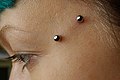 Crows feet piercing