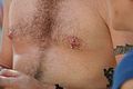 Vertical nipple piercing (male, with barbell)